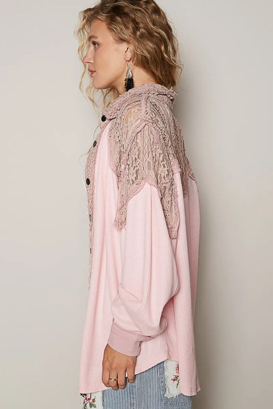 Lace Trim Button-Up Oversized Jacket